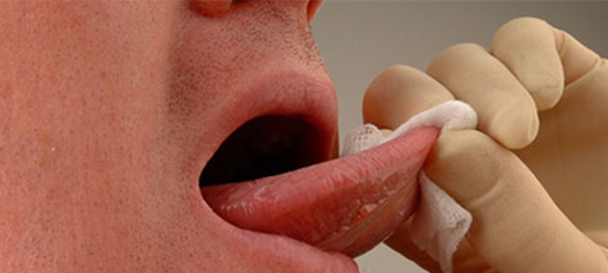 Dental 3 tongue exam ocf